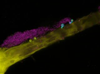 Illustration for article titled This Fungus Is Growing All Over Your Body